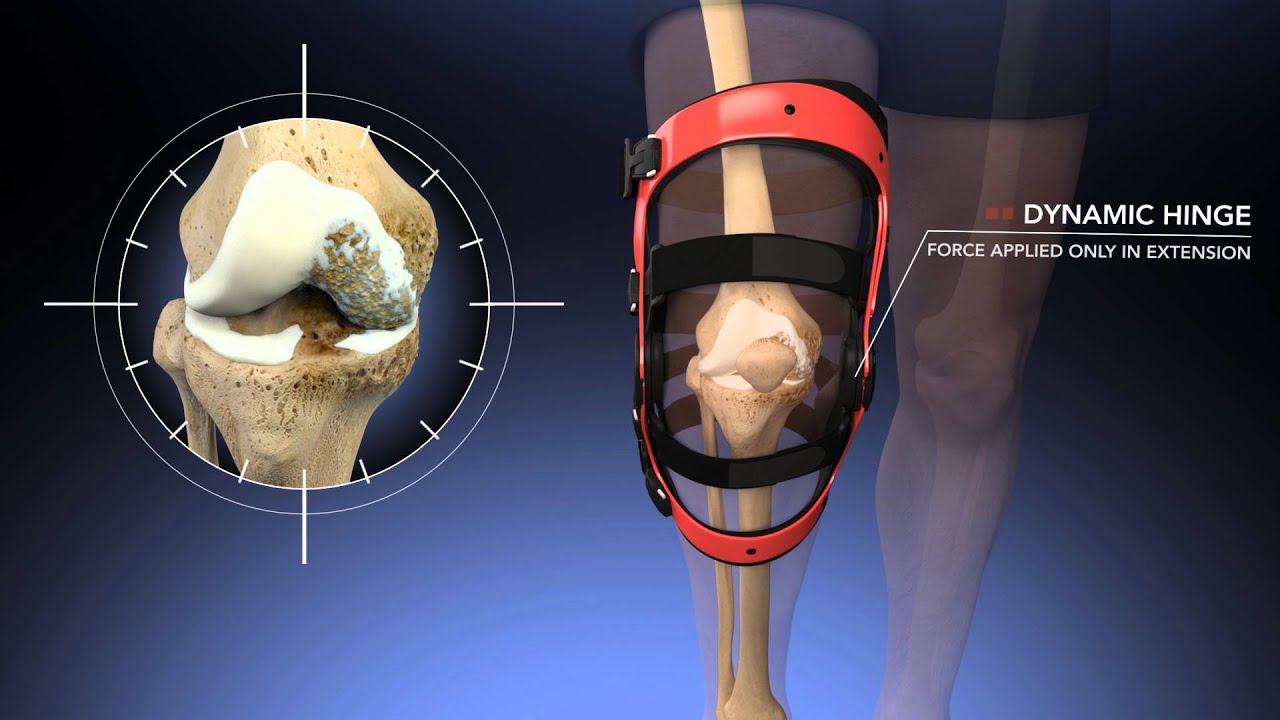 Breg DUO Dynamic Osteoarthritis Bracing