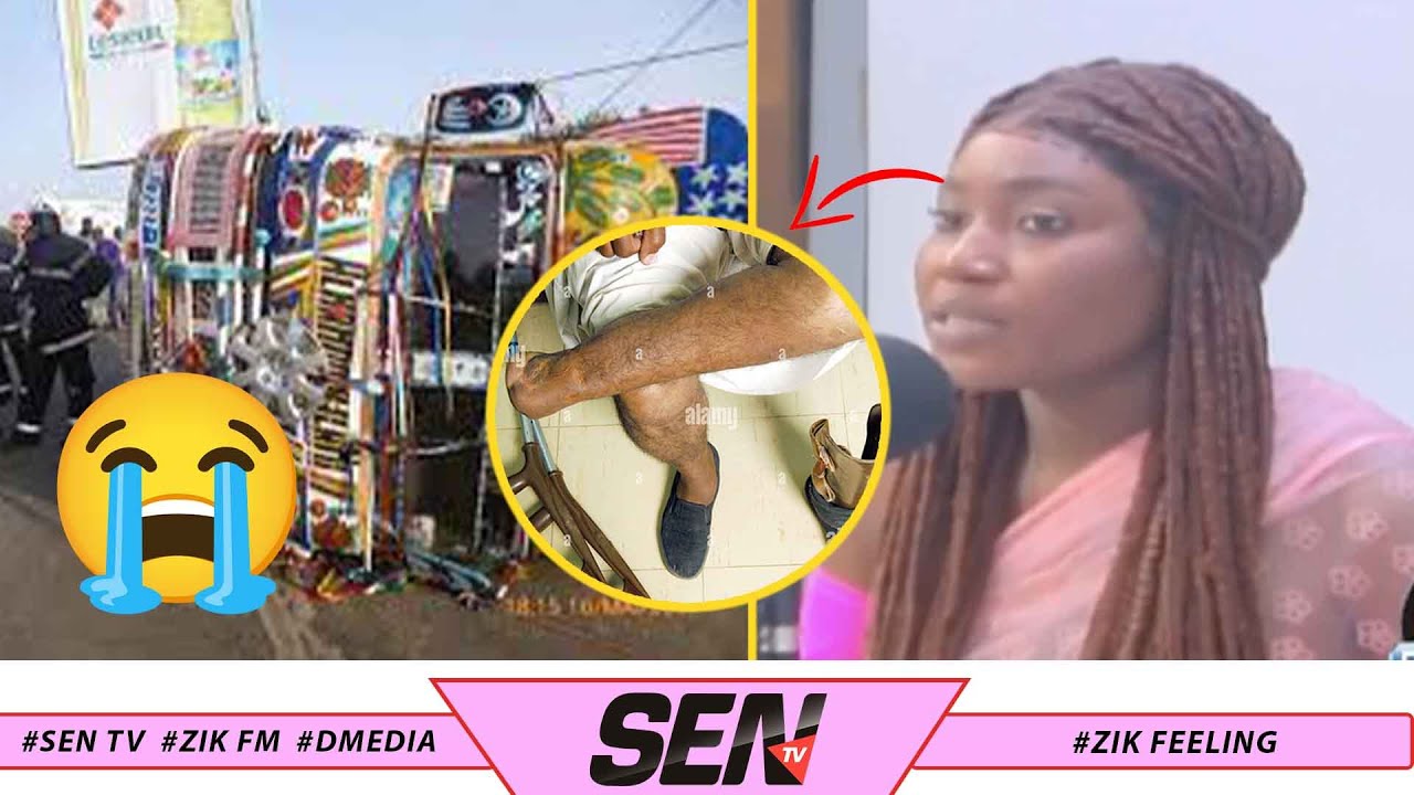 Triste histoire, la tiktokeuse Oumy raconte comment elle a perdu sa jambe 