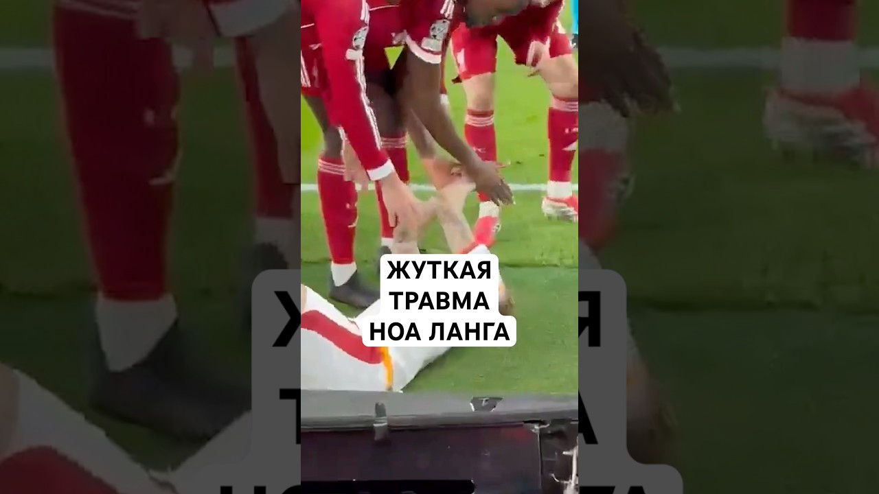 ЖУТКАЯ ТРАВМА НОА ЛАНГА // ФУТБОЛИСТ ЧУТЬ НЕ ЛИШИЛСЯ ПАЛЬЦА В МАТЧЕ ЛИГИ ЧЕМПИОНОВ
