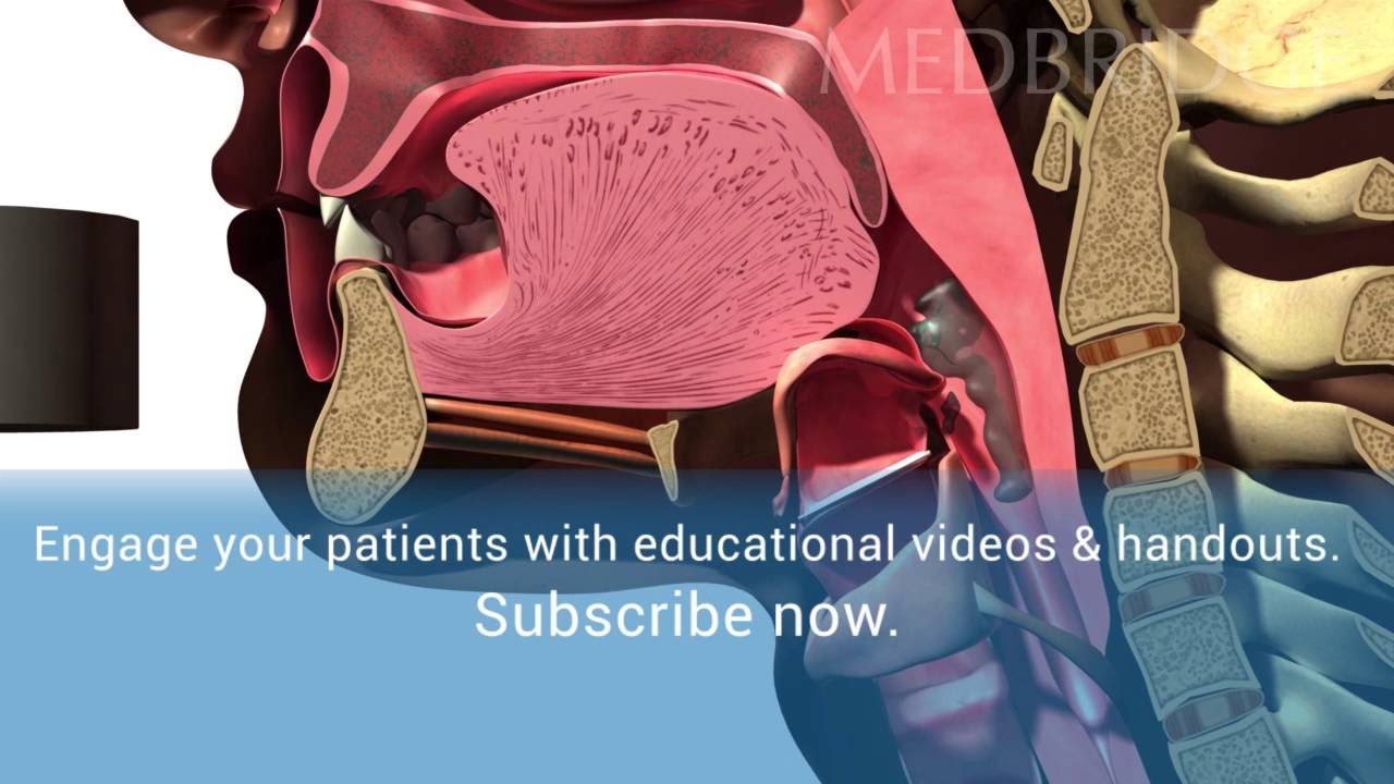 Видео о нормальном глотании &mdash; обучение пациентов | MedBridge