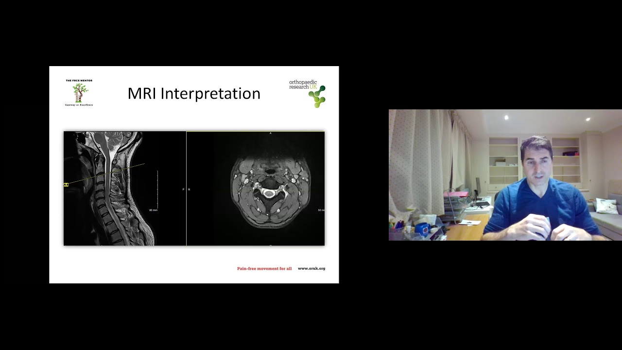 Metastatic Spinal Cord Compression