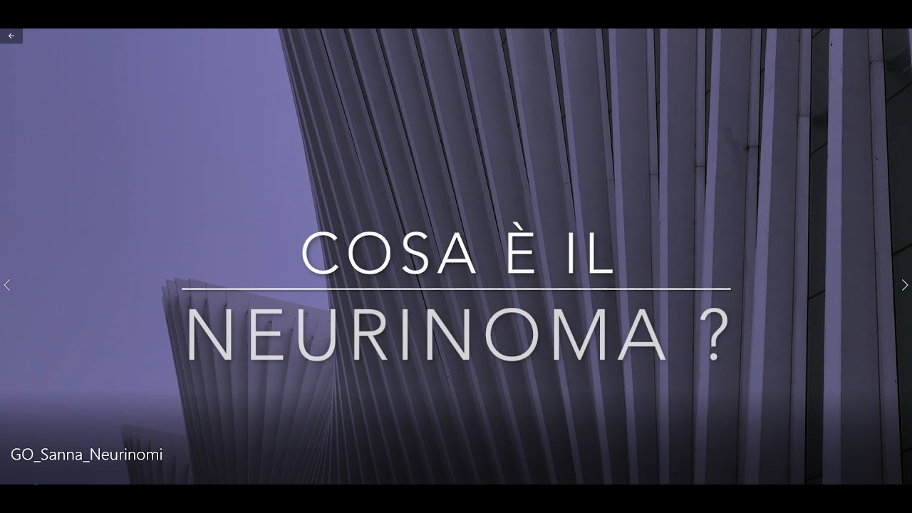 Il Prof. Mario Sanna spiega che cosa è il neurinoma del nervo acustico