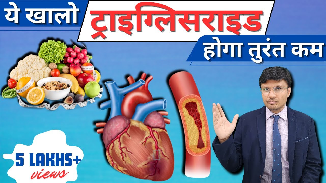 Triglycerides:-Top 10 Foods to  Lower Triglyceride Levels