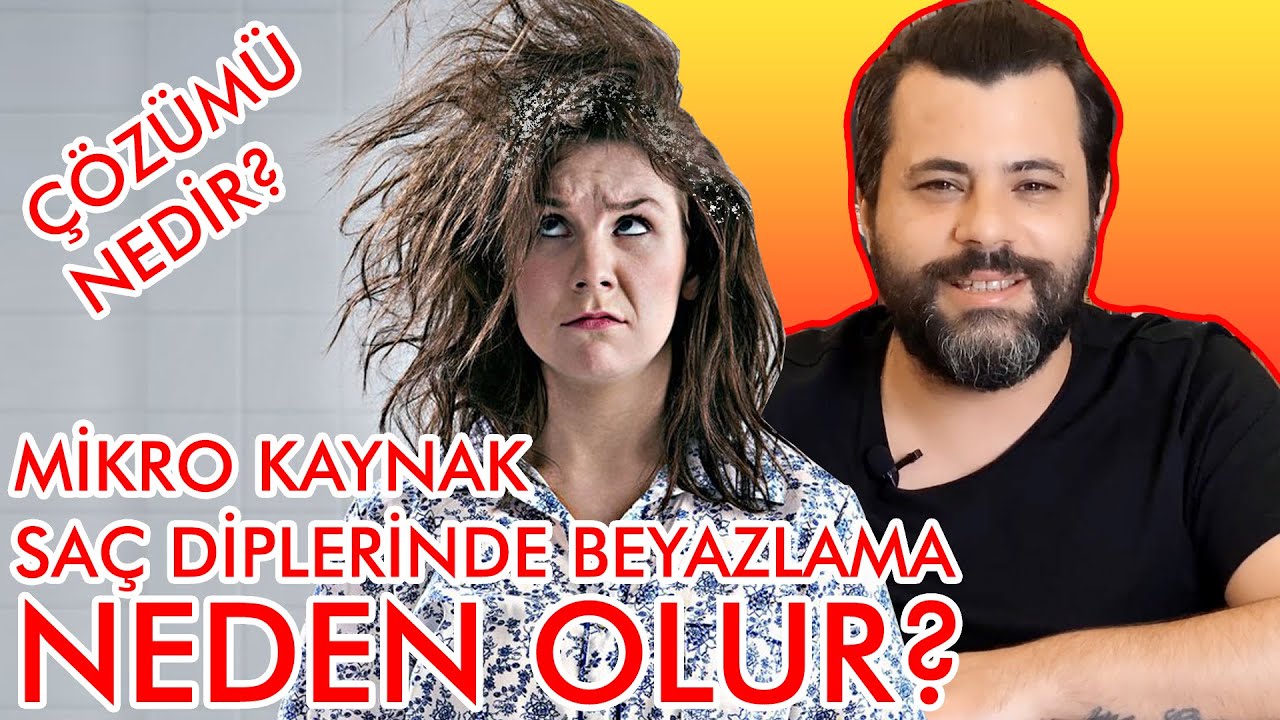 Mikro Kaynak Saç Diplerinde Beyazlama Nedeni?