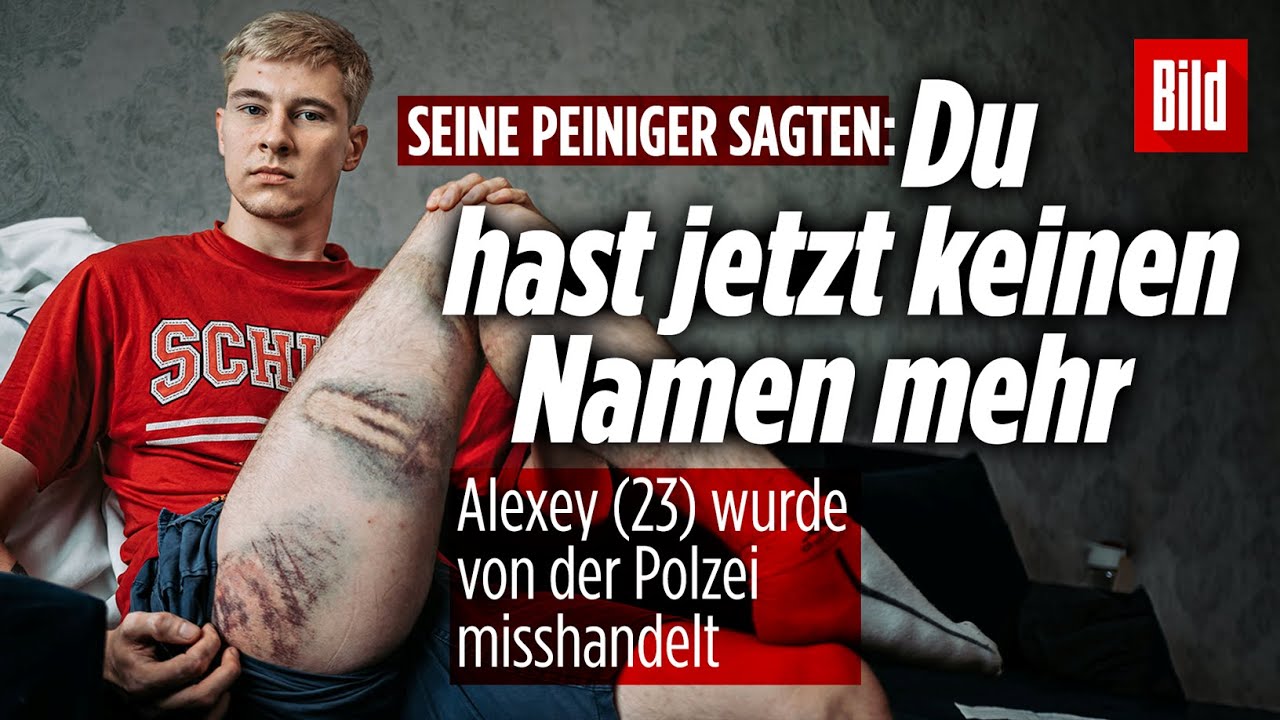Folter-Opfer Alexey aus Weißrussland zeigt seine Wunden