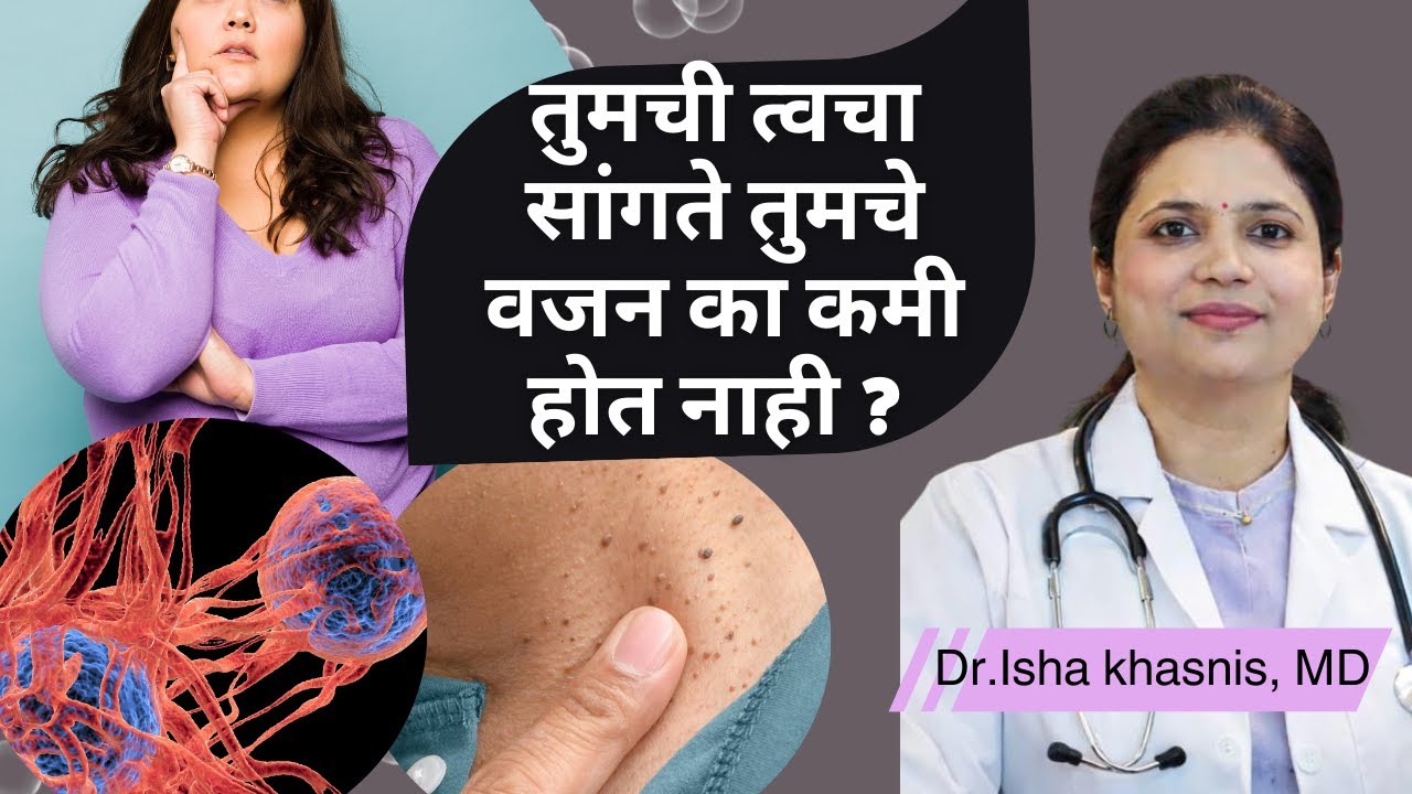 तुमची त्वचा सांगते तुमचे वजन का कमी होत नाही ?