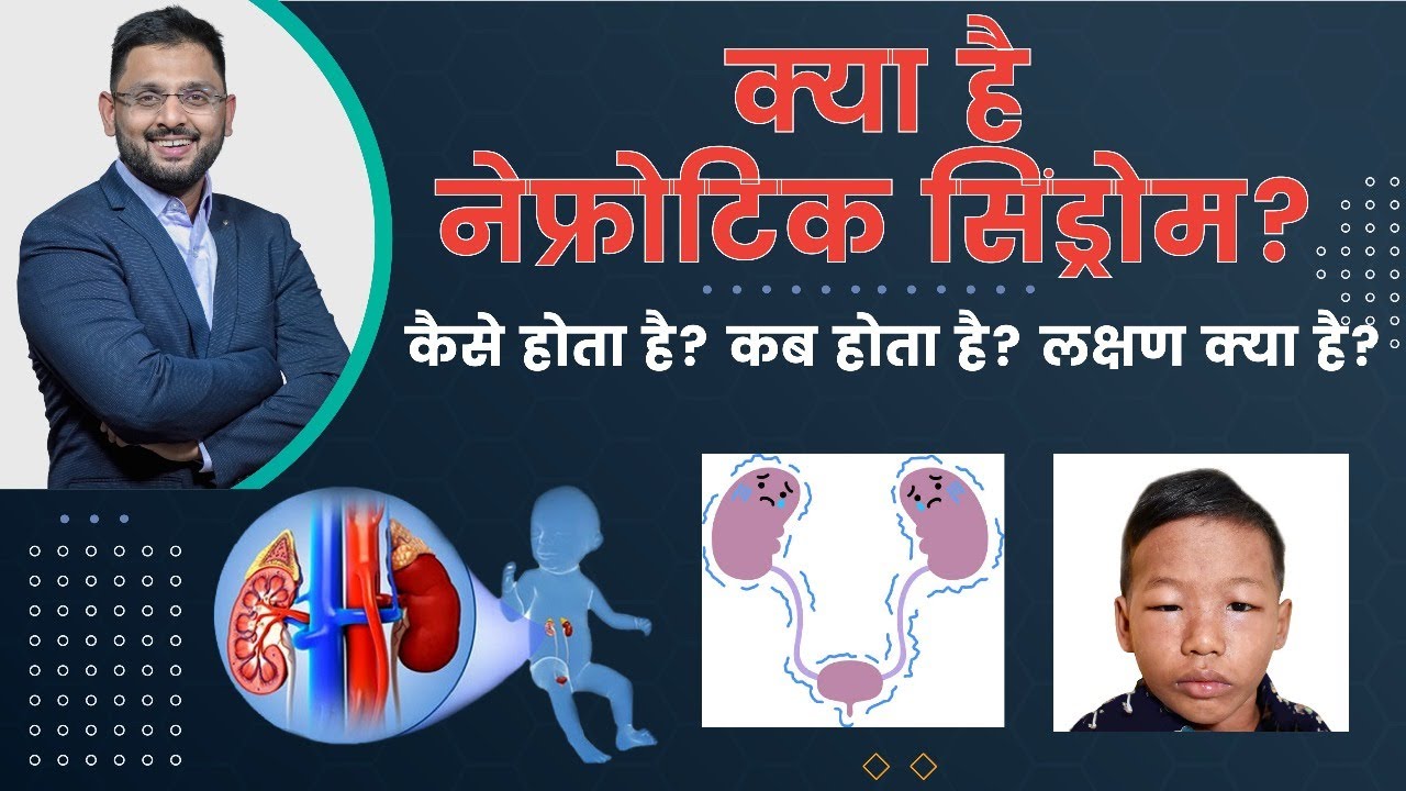 नेफ्रोटिक सिंड्रोम क्या है? | What Is Nephrotic Syndrome in Children | Dr. Kunal Pai