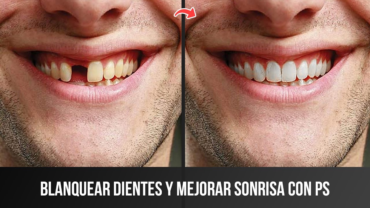 SONRISA PERFECTA en PHOTOSHOP: Cómo CAMBIAR EL COLOR DE LOS DIENTES y agregar dientes en Photoshop
