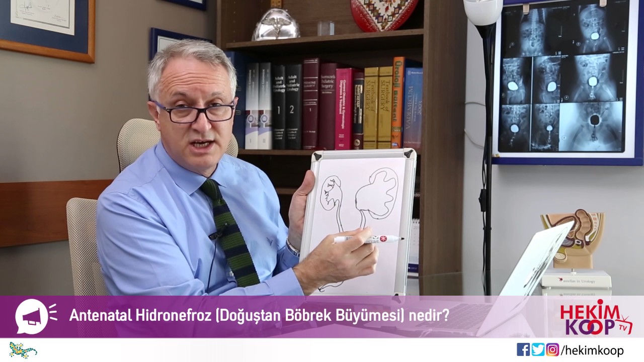 Antenatal Hidronefroz (Doğuştan Böbrek Büyümesi) Nedir?