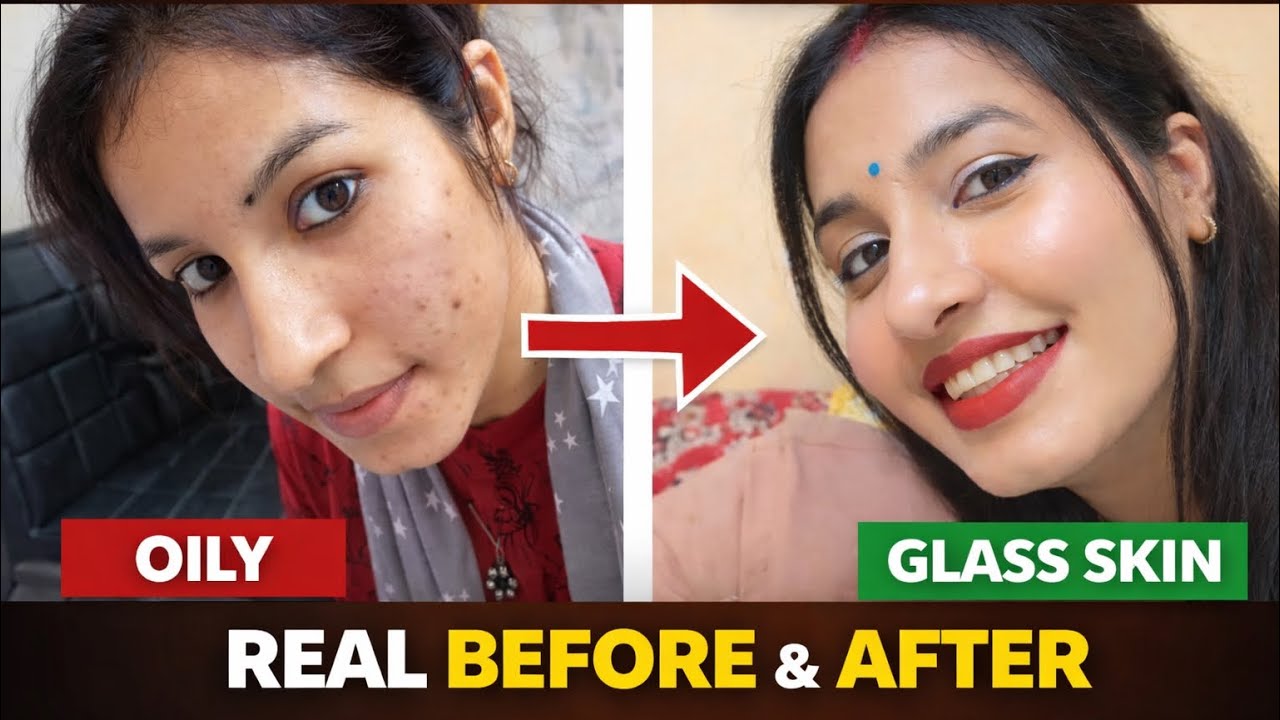 Glass Skin Routine for Oily & Combination Skin | Real Results😍