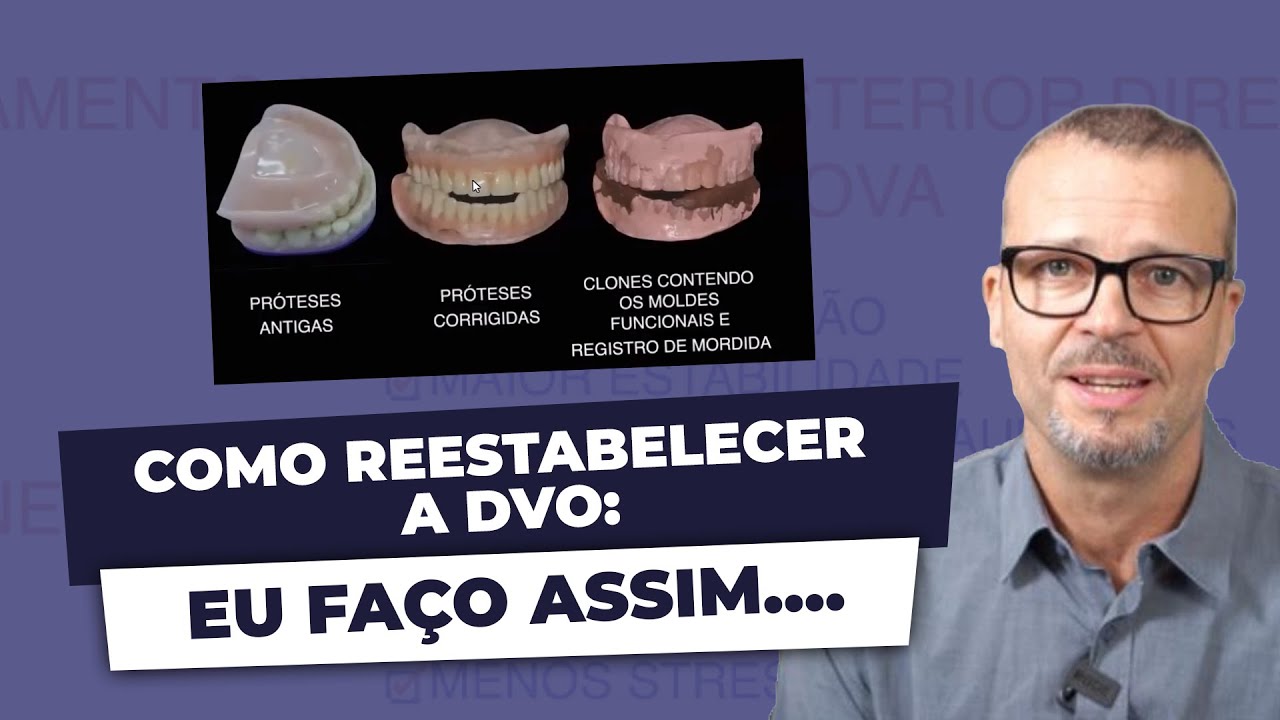 Como Reestabelecer a DVO: Eu fa&ccedil;o assim....
