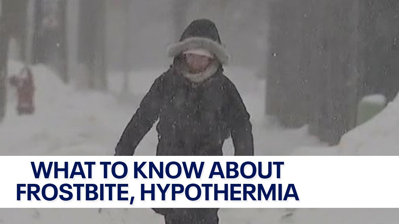 Risk of frostbite, hypothermia; doctors shares what to know | FOX6 News Milwaukee