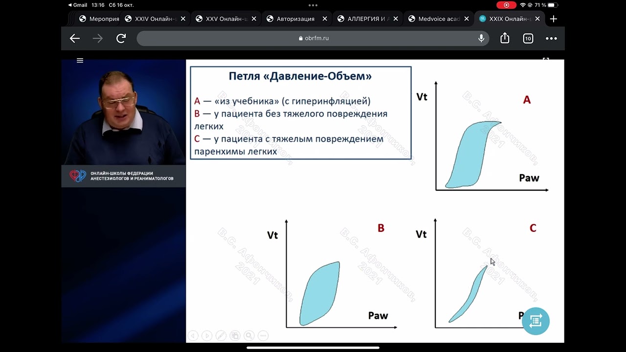 Аппарат ИВЛ