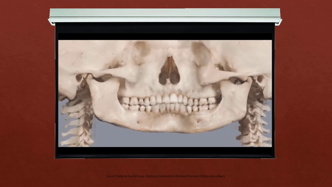 Introduction to Panoramic Radiography