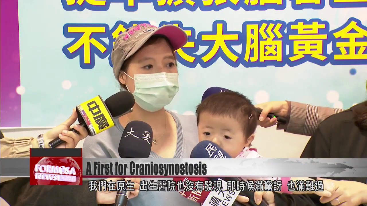 Baby girl first in Taiwan to get cranial traction device for rare disorder