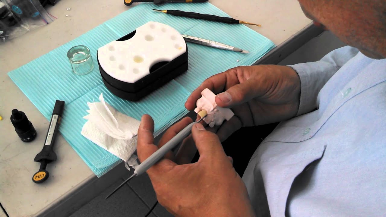 Caracterizado de resina dental