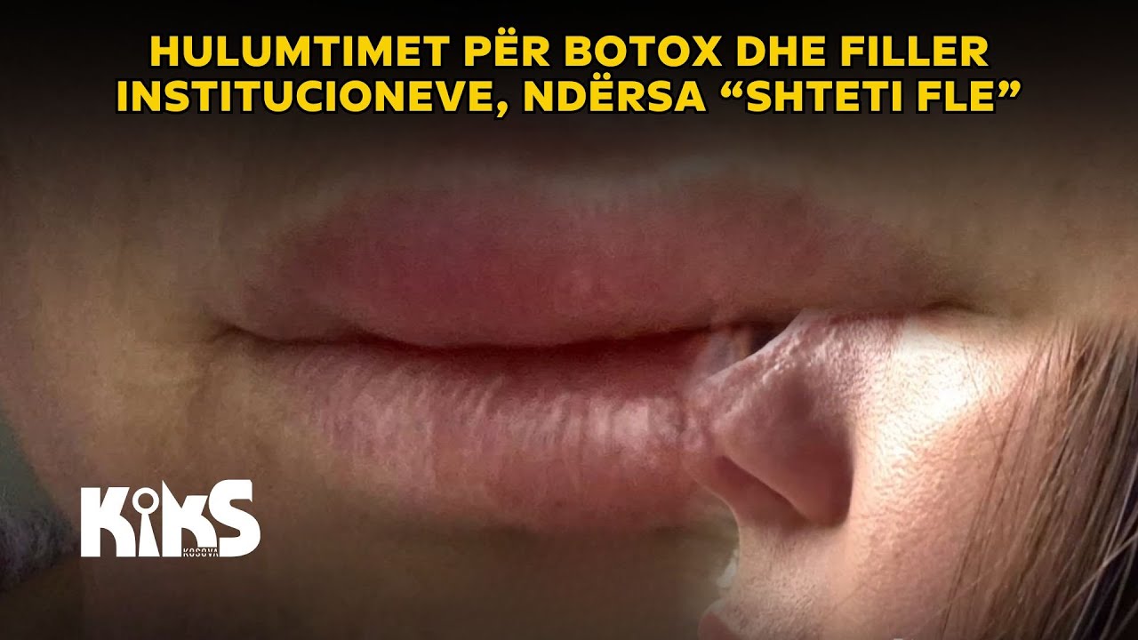 &ldquo;Kiks Kosova&rdquo; i servon hulumtimet p&euml;r Botox dhe Filler institucioneve, nd&euml;rsa &ldquo;shteti fle&rdquo;