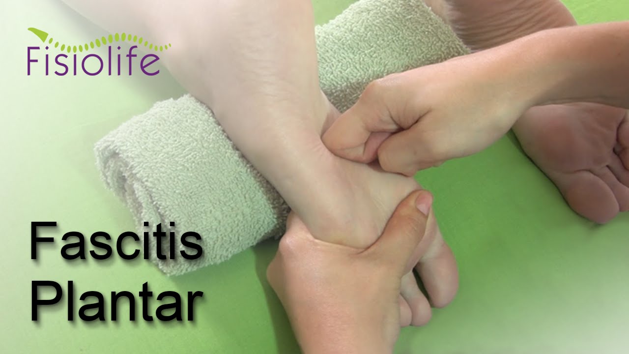 🦶Fascitis Plantar. Diagnóstico, tratamiento y consejos | FISIOLIFE 😁