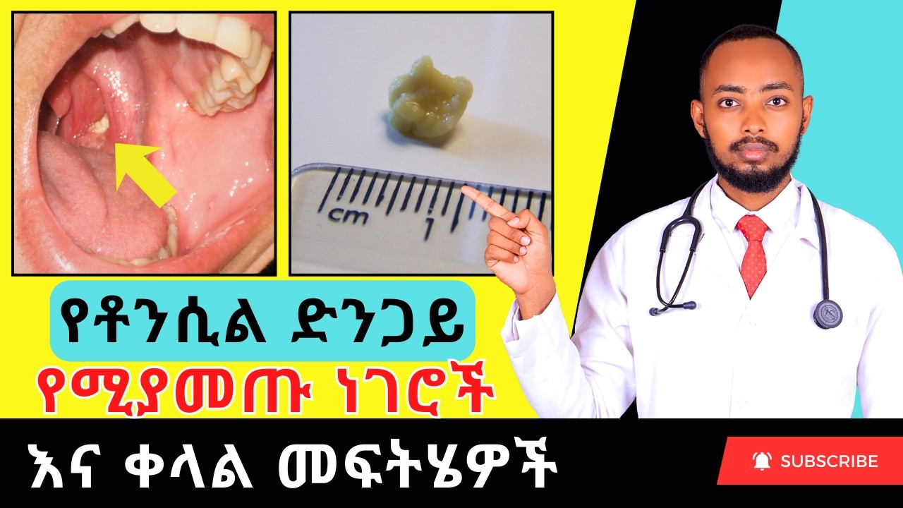 በጉሮሮ ህመም እና በመጥፎ የአፍ ሽታ ለምትሰቃዩ 🚨 ይህ ቪዲዮ ለእናንተ ነው። የቶንሲል ድንጋይ (TONSILLAR STONE) ምልክቶች እና መፍትሄዎች