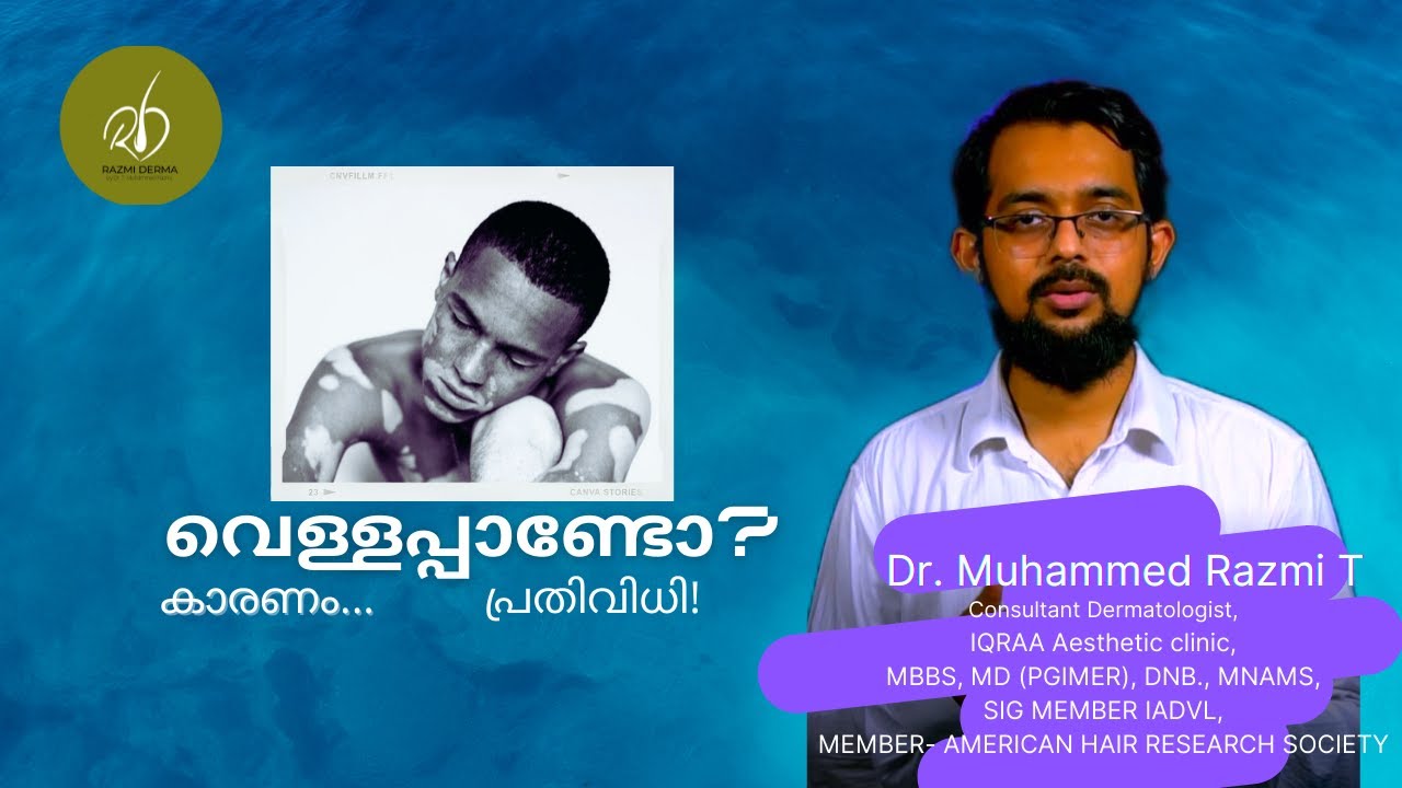 വെള്ളപ്പാണ്ടിനെ ഒരു കളങ്കമായി കാണേണ്ടതില്ല !| talking about Vitiligo| DrRazmiSpeaks|