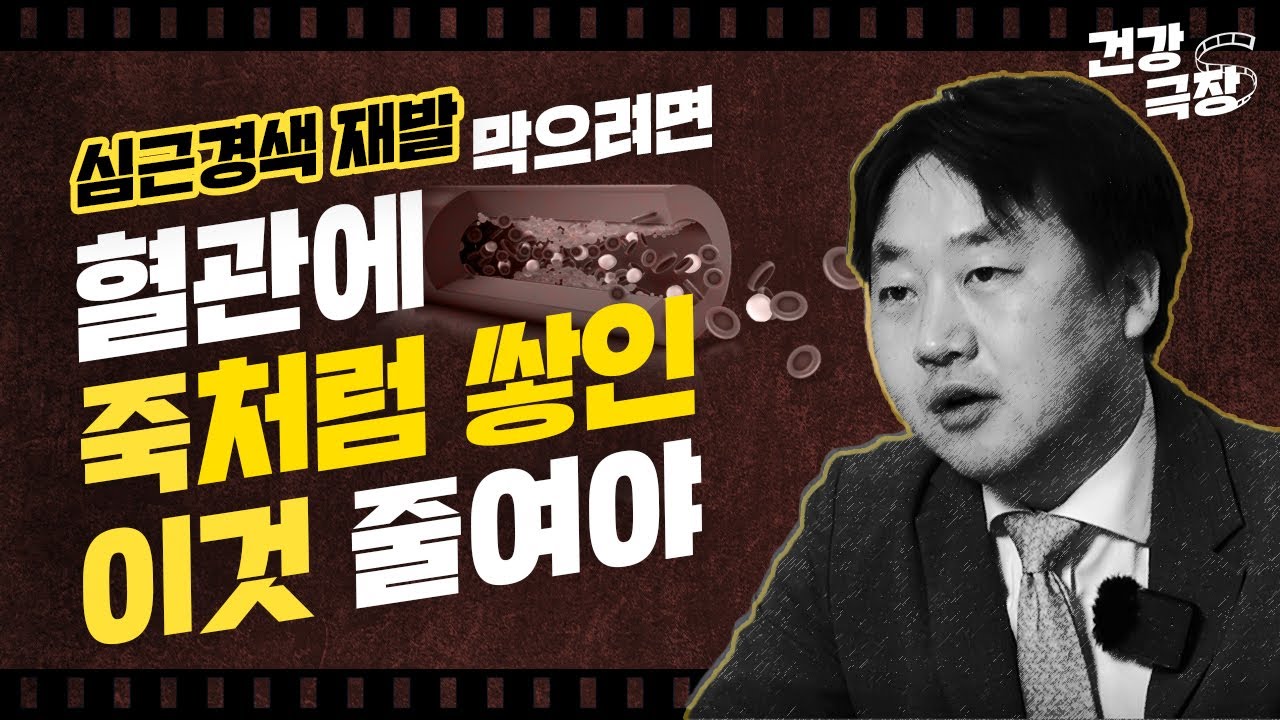 [죽상동맥경화증] 이유 있는 심근경색, 뇌졸중. 범인은 바로 너, 혈관!