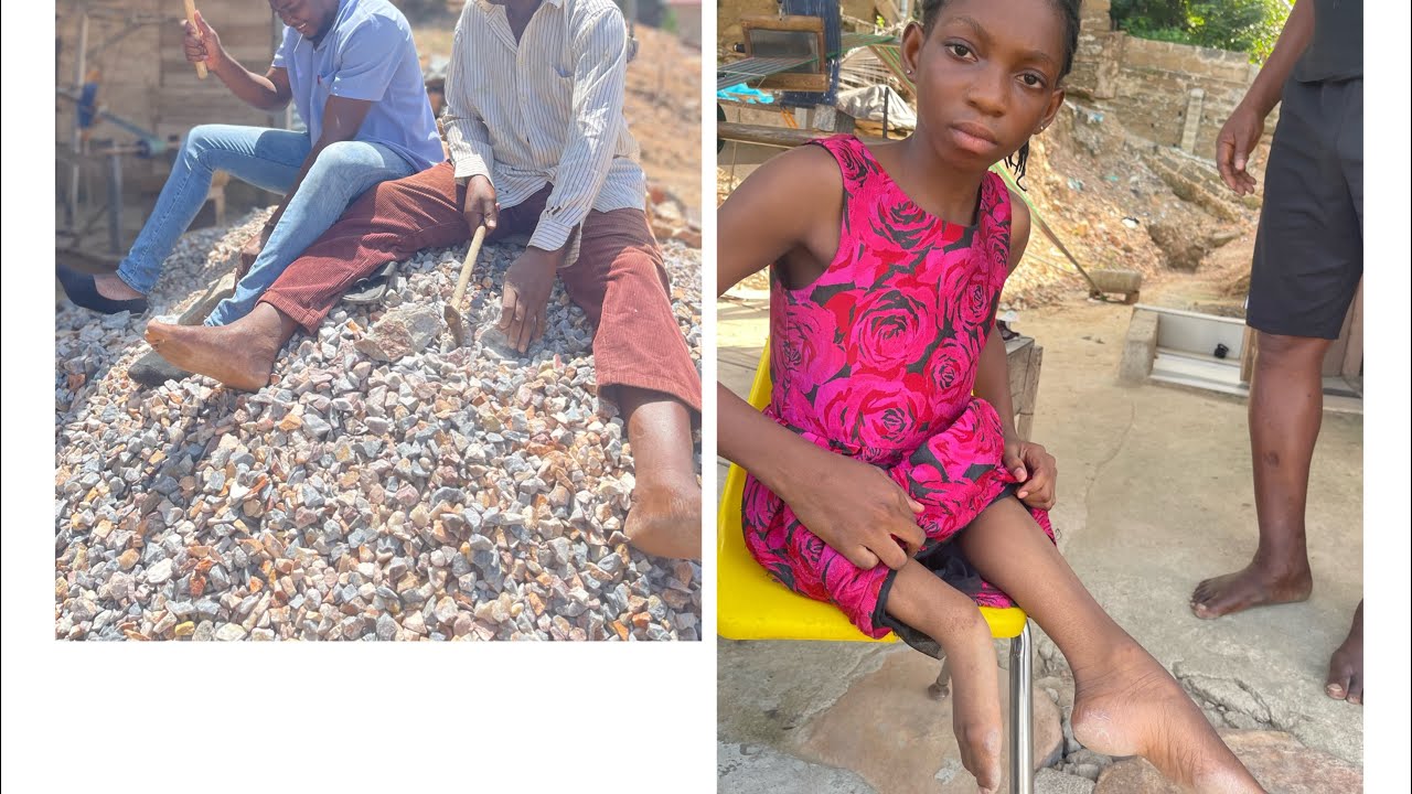 AGAINST ALL ODDS - FATHER CARES FOR PHYSICALLY CHALLENGED CHILD AFTER WIFE ABANDONED THEM