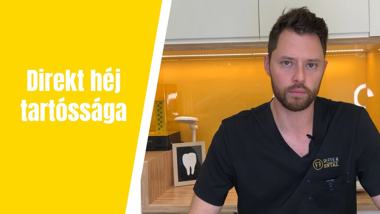 Direkt héj tartóssága