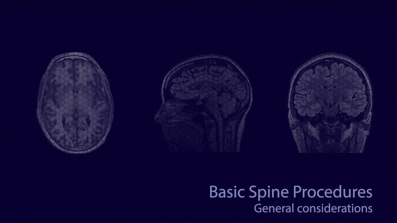 Basic neuroradiology procedures part 1 - General considerations