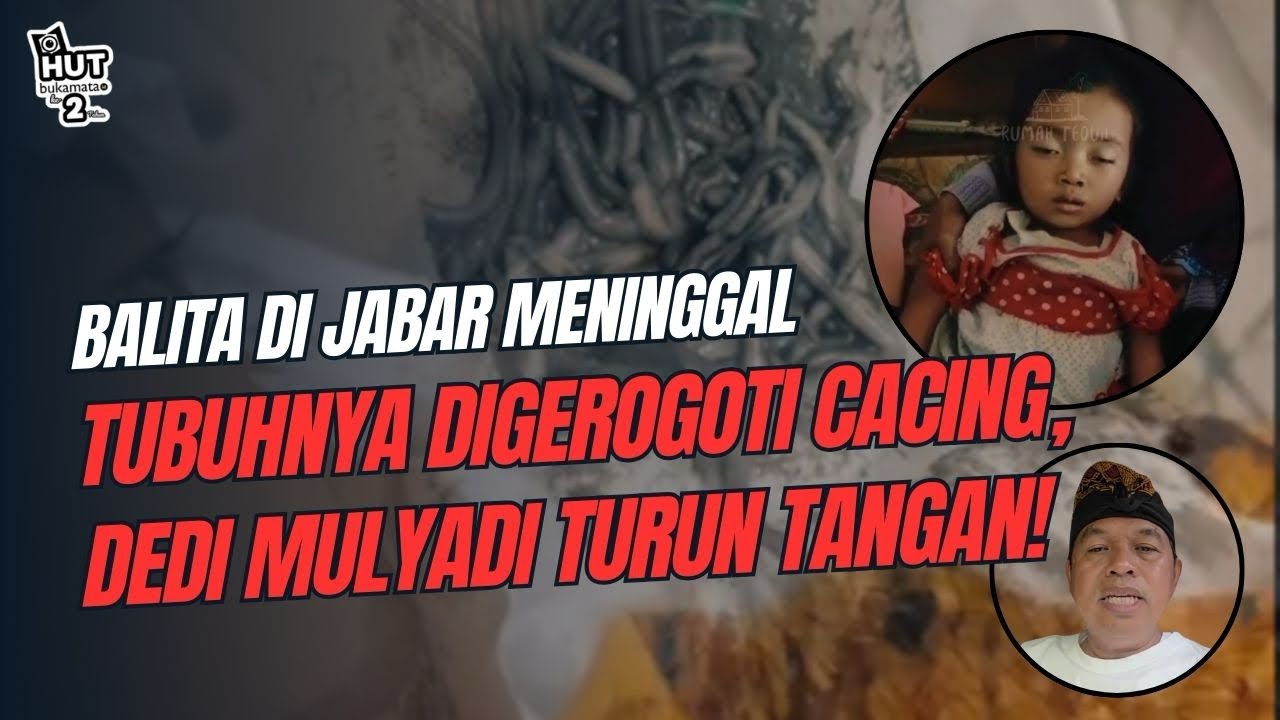 Kisah Pilu Raya, Balita di Jabar Meninggal dengan Tubuh Digerogoti Cacing | Ini Kata Dedi Mulyadi!