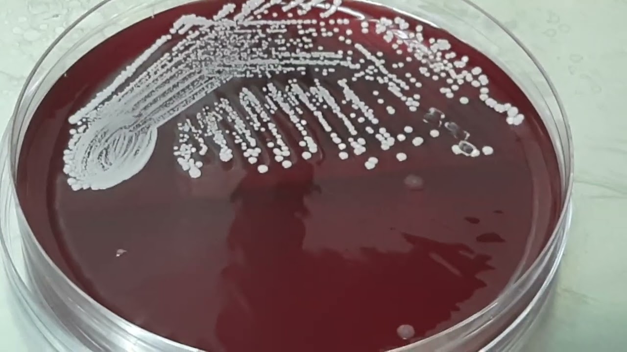 Colony characteristics of Staphylococcus hominis on blood agar of blood culture