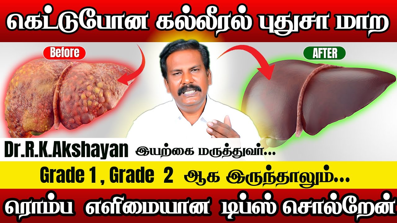 Fatty Liver : உங்க கல்லீரலை புத்தம் புதுசாக மாற்றலாம் | Dr.RK.Akshayan