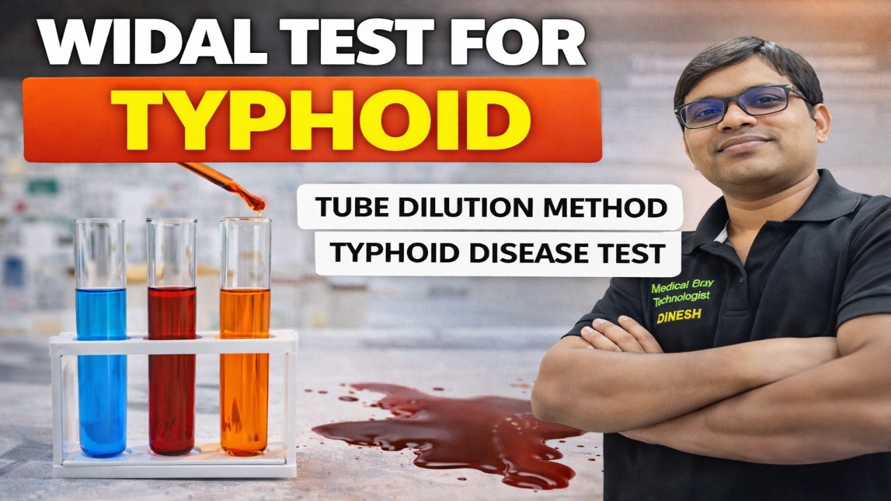 Widal test for typhoid | Tube dilution method widal test | Typhoid disease test