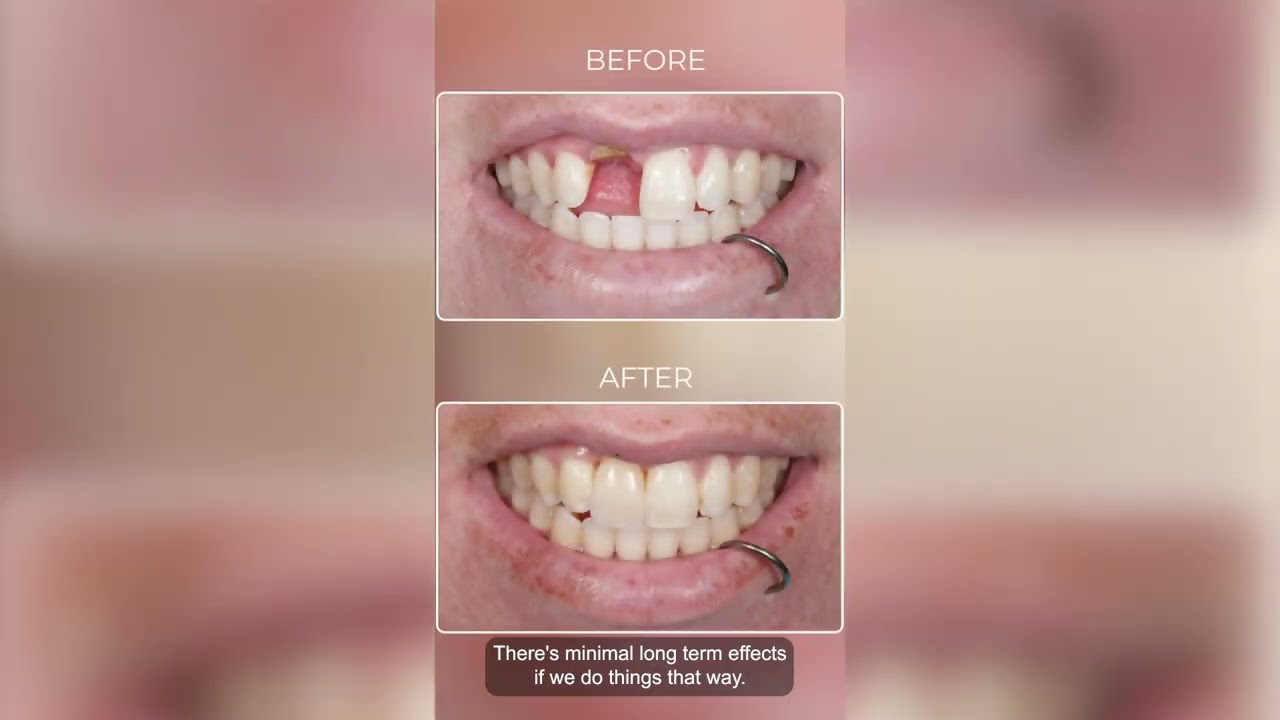 Type of Dental Emergencies at My Emergency Dentist