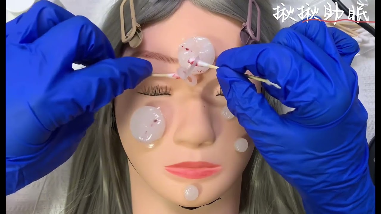 模拟为你针清祛痘 很解压的一期！ #asmr #助眠 #声控助眠 #解压声控 #asmr助眠视频