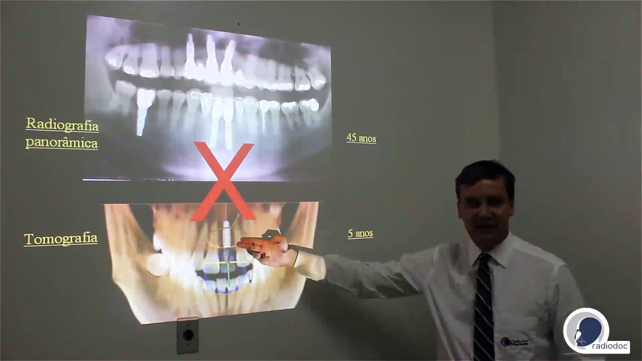 Radiografia Panorâmica x Tomografia - Radiodoc