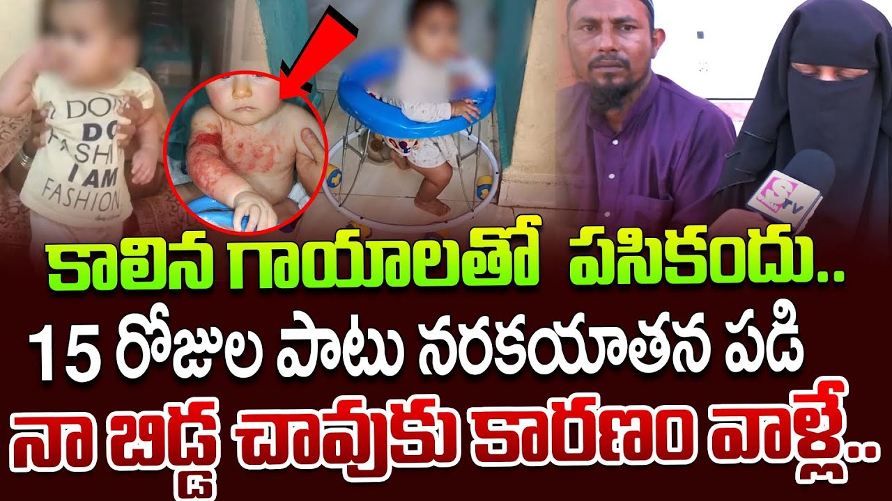Parents Emotional Words || Kurnool Latest News Updates || Baby with burns.|| SumanTV Lifestyle ||