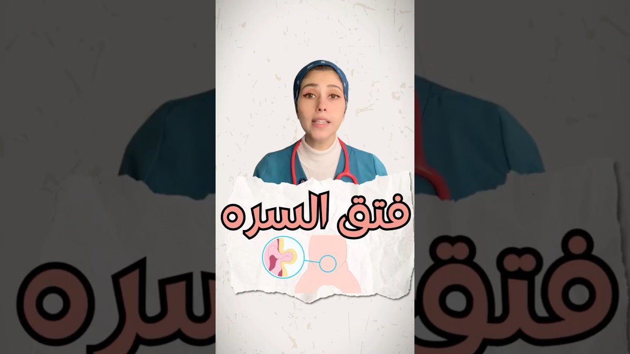 سرّة طفلك بارزة؟ إمتى يكون ده فتق سري ونعالجه إزاي؟ | د/آيه عسل