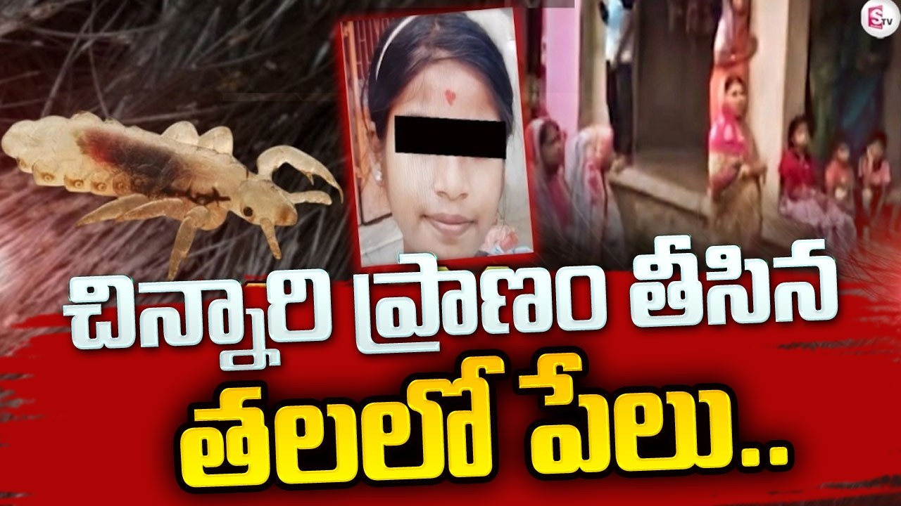 🔴LIVE : 12 ఏళ్ల బాలిక ప్రాణం తీసిన తలలో పేలు! | Head Lice Infestation | Odissa News