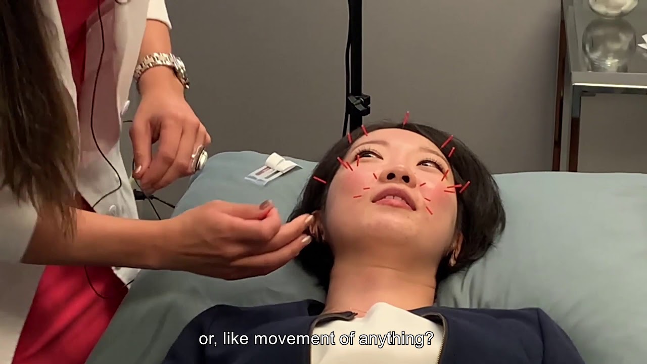 The Best Needles for Cosmetic Acupuncture - Seirin Needles