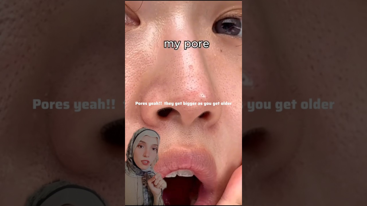 HOW TO GET A RID OF LARGE PORES⁉️😱🚨(Follow for more!)#acne #skincareoutine #skincare #skin #beauty