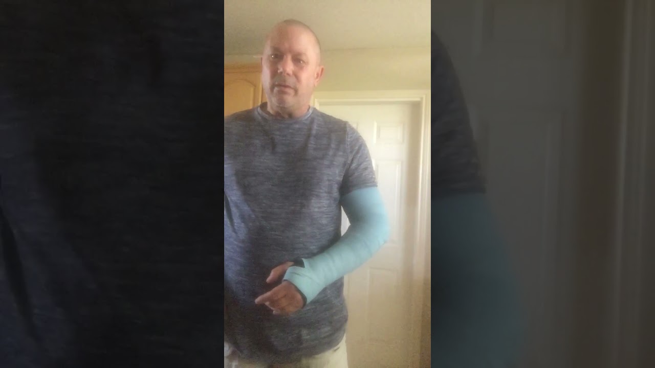 Getting dressed with two broken arms!