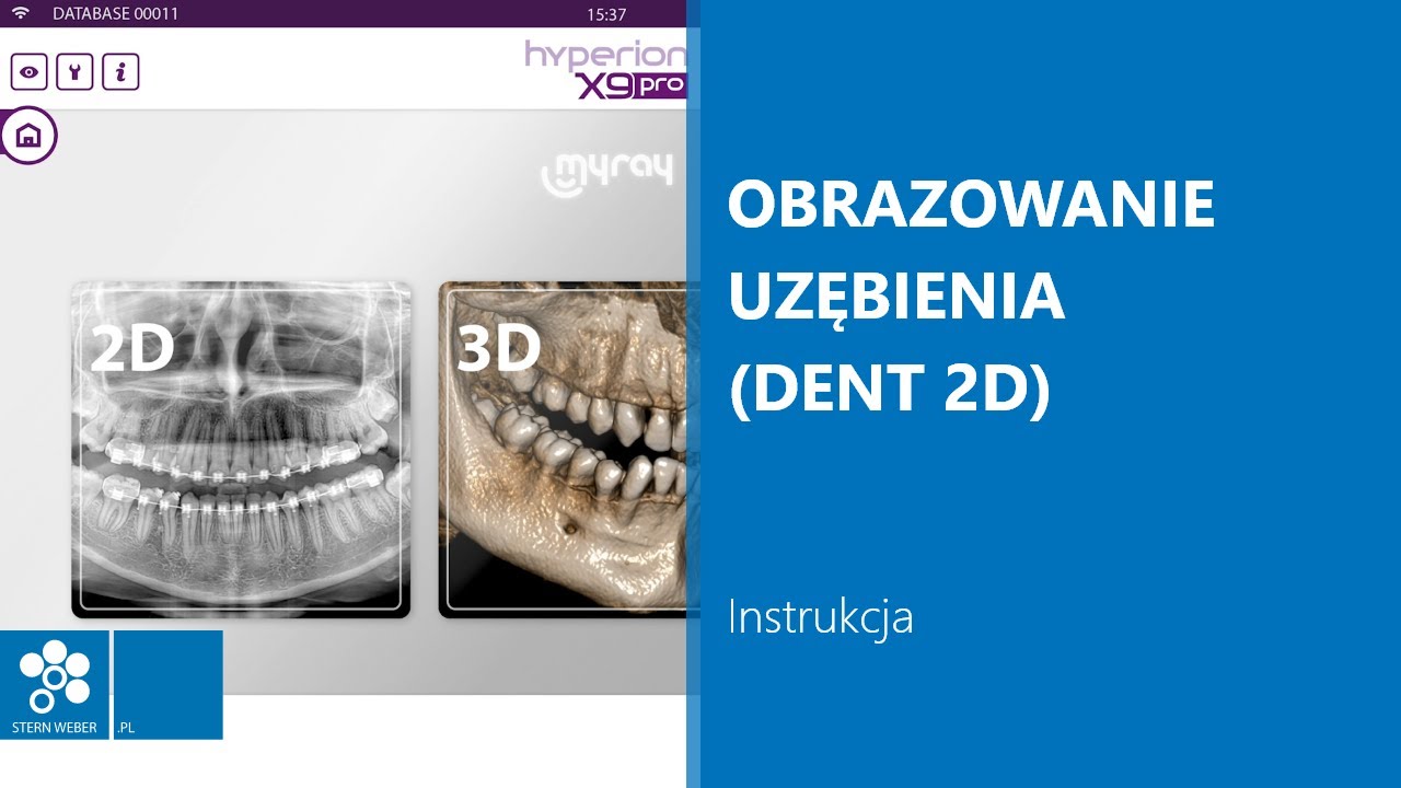 Obrazowanie uzębienia (DENT 2D) | Instrukcja wykonywania badania w MyRay Hyperion X9