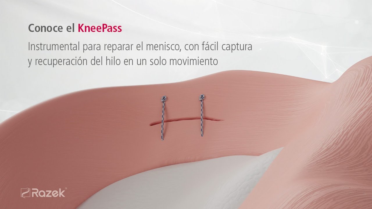 𝗞𝗻𝗲𝗲𝗣𝗮𝘀𝘀 - Instrumento de Artroscopia Razek