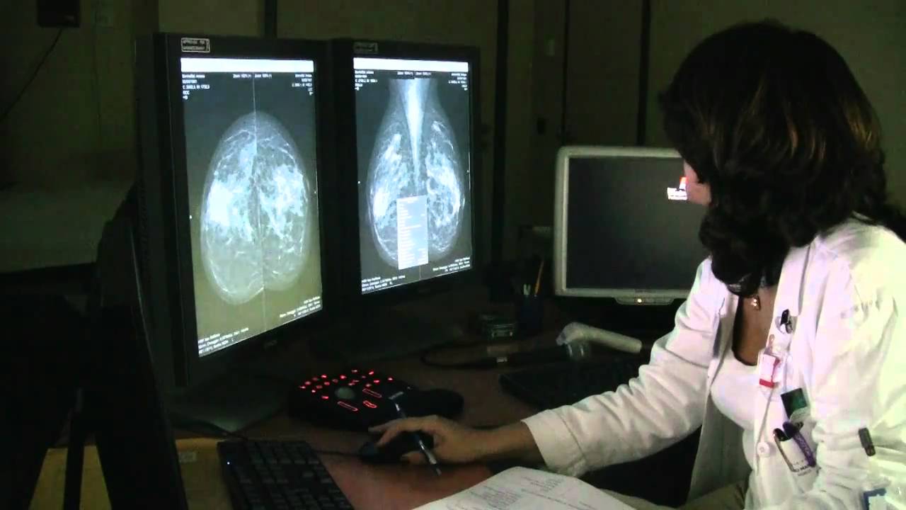 Screening mammografico.mov