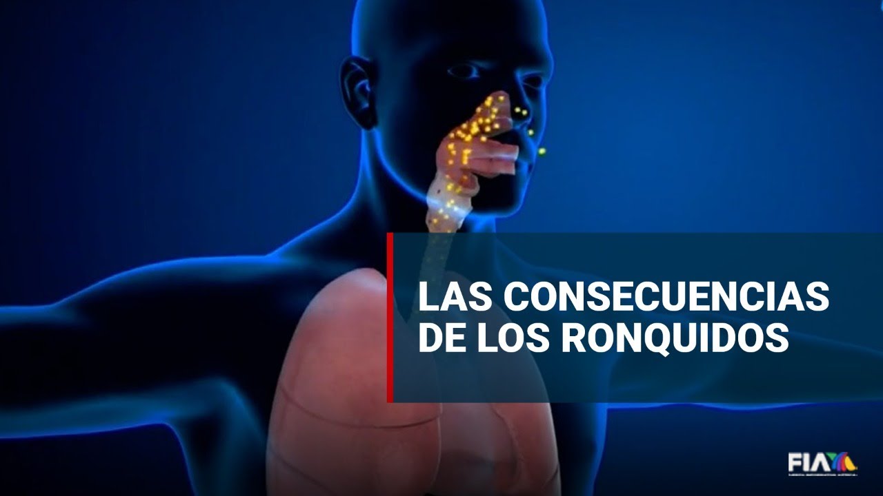 &iexcl;Cuidado! Los ronquidos pueden traer consecuencias para la salud