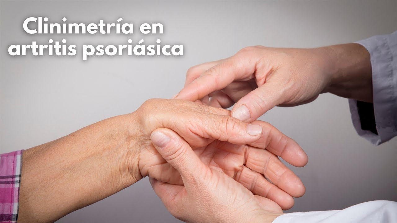 Clinimetría en artritis psoriásica