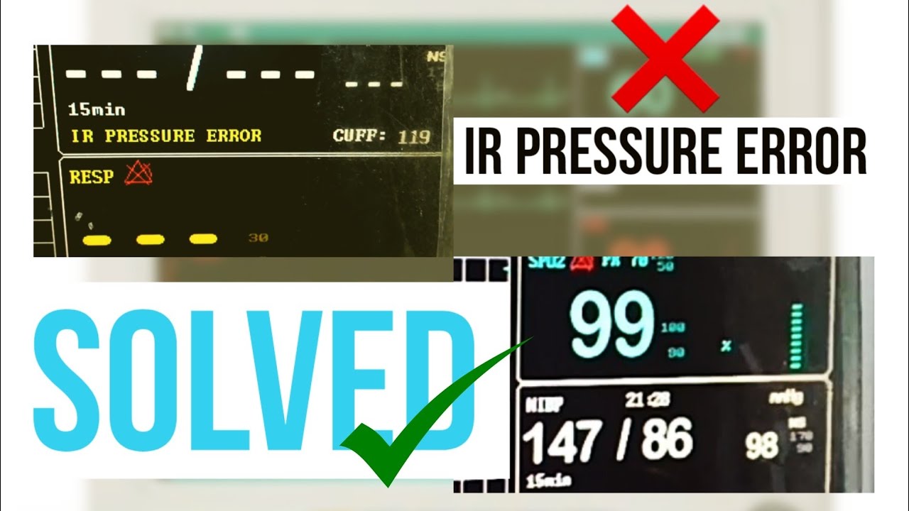 IR PRESSURE ERROR in Multipara Monitor Solved | Mr Biomedical