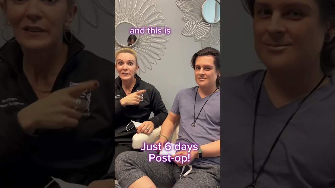 Facial Masculinization Surgery / FMS - Testimonial • Dr. Rodman in Houston, TX