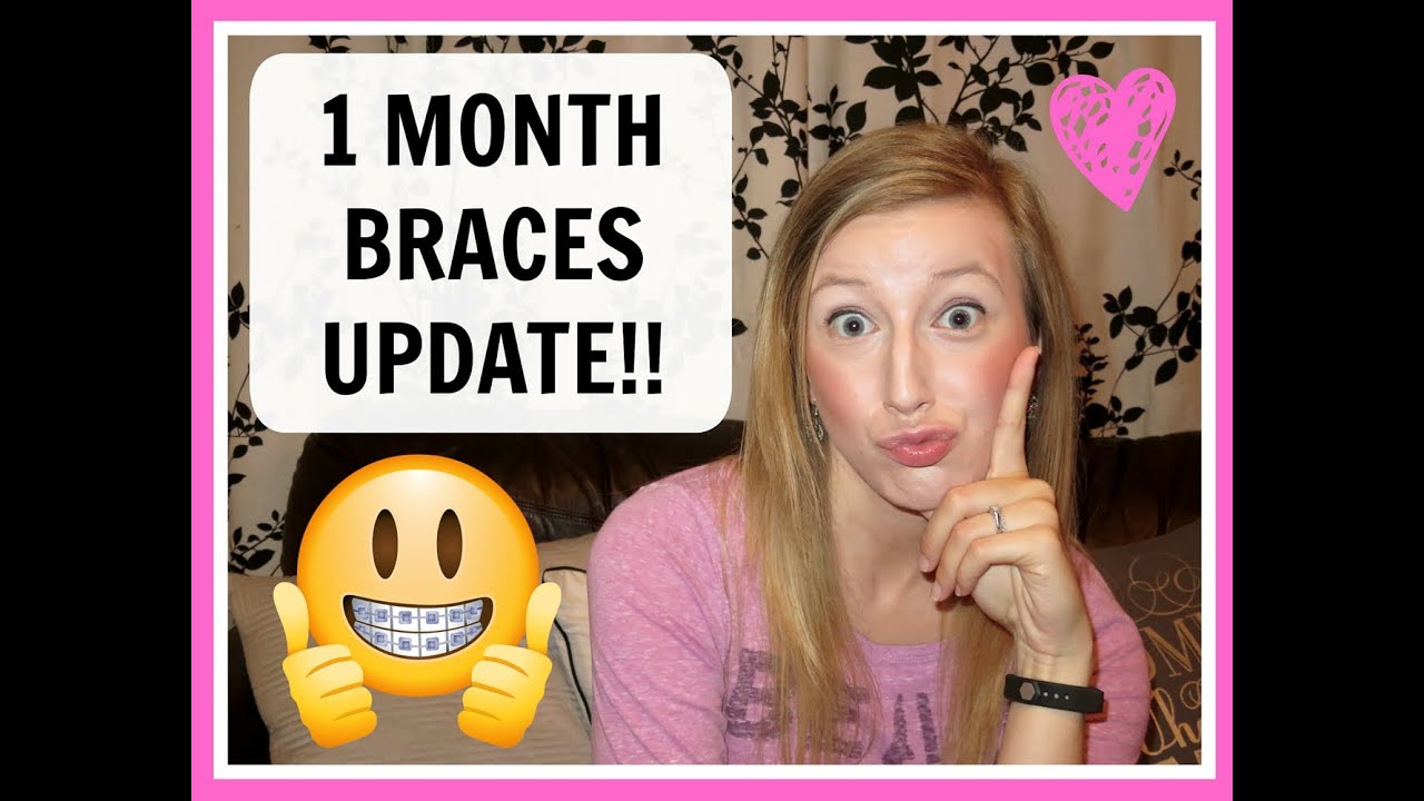ADULT BRACES // 1 MONTH UPDATE!!!