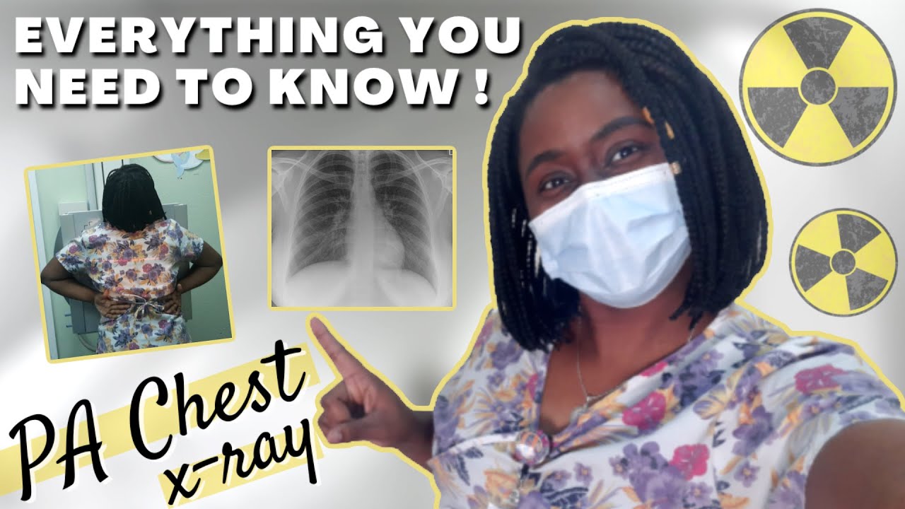 how to: PA CHEST X-RAY ~ positioning, evaluation criteria & critiques || Ask The Rad Tech